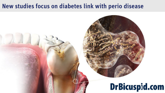 New studies focus on diabetes link with perio disease