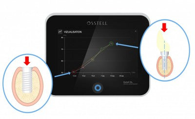 Osstell IDx - W FREE BOX OF SMARTPEGS!!